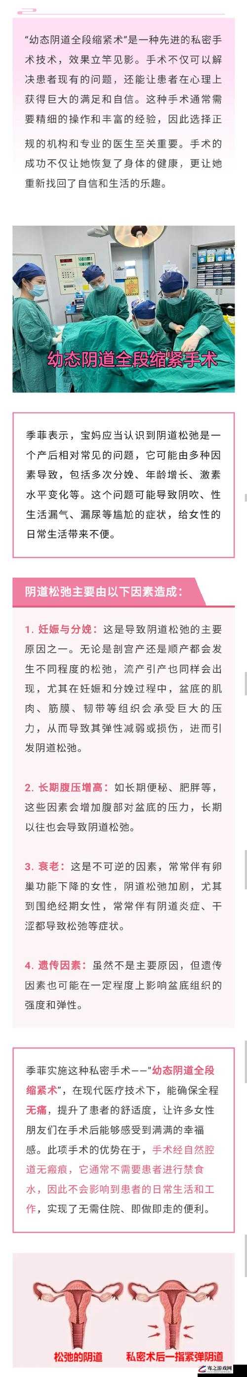 女人私密处松弛状况引发的关注与思考