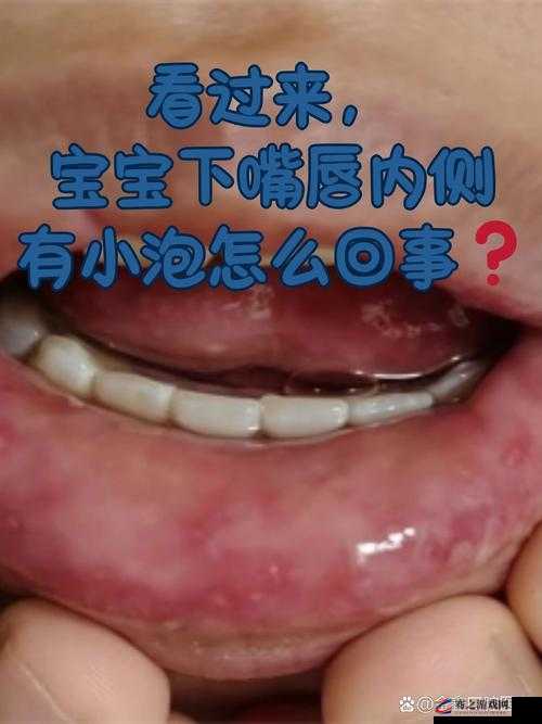 宝宝下面湿透还嘴硬疼：可能的原因与解决方法